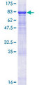 CLEC14A Protein - 12.5% SDS-PAGE of human CLEC14A stained with Coomassie Blue