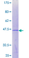 CLEC1B / CLEC-2 Protein - 12.5% SDS-PAGE of human CLEC1B stained with Coomassie Blue