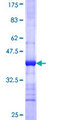 CLEC1B / CLEC-2 Protein - 12.5% SDS-PAGE Stained with Coomassie Blue.