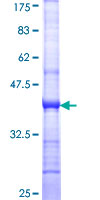 CLEC2B / AICL Protein - 12.5% SDS-PAGE Stained with Coomassie Blue.
