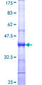 CLEC2B / AICL Protein - 12.5% SDS-PAGE Stained with Coomassie Blue.