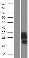 CLEC2D / OCIL / LLT1 Protein - Western validation with an anti-DDK antibody * L: Control HEK293 lysate R: Over-expression lysate