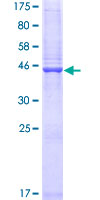 CLEC2D / OCIL / LLT1 Protein - 12.5% SDS-PAGE of human CLEC2D stained with Coomassie Blue