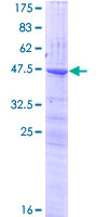 CLEC3A Protein - 12.5% SDS-PAGE of human CLEC3A stained with Coomassie Blue