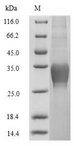 CLEC4C / CD303 / BDCA-2 Protein - (Tris-Glycine gel) Discontinuous SDS-PAGE (reduced) with 5% enrichment gel and 15% separation gel.