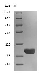 CLEC4C / CD303 / BDCA-2 Protein - (Tris-Glycine gel) Discontinuous SDS-PAGE (reduced) with 5% enrichment gel and 15% separation gel.