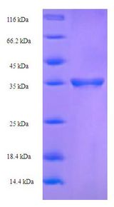 CLEC4C / CD303 / BDCA-2 Protein