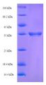 CLEC4C / CD303 / BDCA-2 Protein