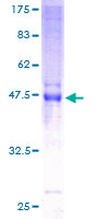 CLEC4E / MINCLE Protein - 12.5% SDS-PAGE of human CLEC4E stained with Coomassie Blue