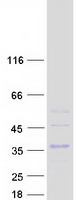CLEC4E / MINCLE Protein - Purified recombinant protein CLEC4E was analyzed by SDS-PAGE gel and Coomassie Blue Staining