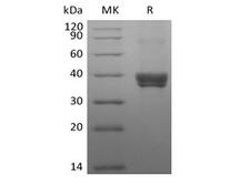 CLEC4M / L-SIGN / CD299 Protein - Recombinant Human DC-SIGNR/CD299 (N-8His-Flag)