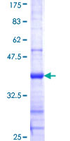 CLEC4M / L-SIGN / CD299 Protein - 12.5% SDS-PAGE Stained with Coomassie Blue.