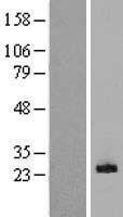 CLEC5A / MDL-1 Protein - Western validation with an anti-DDK antibody * L: Control HEK293 lysate R: Over-expression lysate