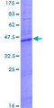 CLEC5A / MDL-1 Protein - 12.5% SDS-PAGE of human CLEC5A stained with Coomassie Blue