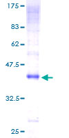 CLEC7A / Dectin 1 Protein - 12.5% SDS-PAGE of human CLEC7A stained with Coomassie Blue