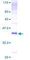CLEC7A / Dectin 1 Protein - 12.5% SDS-PAGE of human CLEC7A stained with Coomassie Blue