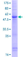 CLEC9A Protein - 12.5% SDS-PAGE of human CLEC9A stained with Coomassie Blue