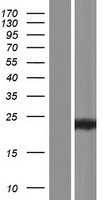 CLECSF6 / DCIR Protein - Western validation with an anti-DDK antibody * L: Control HEK293 lysate R: Over-expression lysate