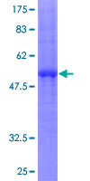 CLECSF6 / DCIR Protein - 12.5% SDS-PAGE of human CLEC4A stained with Coomassie Blue