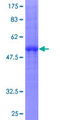 CLECSF6 / DCIR Protein - 12.5% SDS-PAGE of human CLEC4A stained with Coomassie Blue