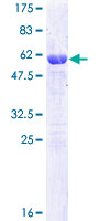 CLIC1 / NCC27 Protein - 12.5% SDS-PAGE of human CLIC1 stained with Coomassie Blue