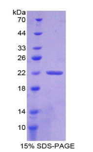 CLIC1 / NCC27 Protein