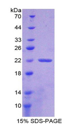 CLIC1 / NCC27 Protein
