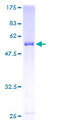 CLIC2 Protein - 12.5% SDS-PAGE of human CLIC2 stained with Coomassie Blue