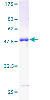 CLIC3 Protein - 12.5% SDS-PAGE of human CLIC3 stained with Coomassie Blue