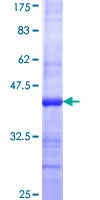 CLIC3 Protein - 12.5% SDS-PAGE Stained with Coomassie Blue.