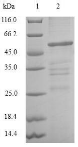 CLIC4 Protein - (Tris-Glycine gel) Discontinuous SDS-PAGE (reduced) with 5% enrichment gel and 15% separation gel.