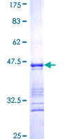 CLIC4 Protein - 12.5% SDS-PAGE Stained with Coomassie Blue.