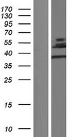 CLIC5 Protein - Western validation with an anti-DDK antibody * L: Control HEK293 lysate R: Over-expression lysate
