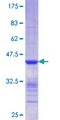 CLIC5 Protein - 12.5% SDS-PAGE Stained with Coomassie Blue.