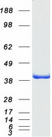 CLIC5 Protein - Purified recombinant protein CLIC5 was analyzed by SDS-PAGE gel and Coomassie Blue Staining