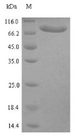 CLINT1 Protein - (Tris-Glycine gel) Discontinuous SDS-PAGE (reduced) with 5% enrichment gel and 15% separation gel.