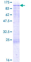 CLINT1 Protein - 12.5% SDS-PAGE of human CLINT1 stained with Coomassie Blue