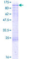 CLINT1 Protein - 12.5% SDS-PAGE of human CLINT1 stained with Coomassie Blue