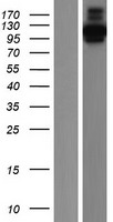 CLIP2 / CYLN2 Protein - Western validation with an anti-DDK antibody * L: Control HEK293 lysate R: Over-expression lysate