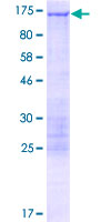 CLIP2 / CYLN2 Protein - 12.5% SDS-PAGE of human CLIP2 stained with Coomassie Blue