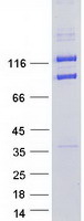 CLIP2 / CYLN2 Protein - Purified recombinant protein CLIP2 was analyzed by SDS-PAGE gel and Coomassie Blue Staining