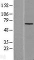 CLIP3 Protein - Western validation with an anti-DDK antibody * L: Control HEK293 lysate R: Over-expression lysate