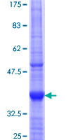 CLIP3 Protein - 12.5% SDS-PAGE Stained with Coomassie Blue.