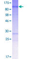 CLIP4 / RSNL2 Protein - 12.5% SDS-PAGE of human CLIP4 stained with Coomassie Blue