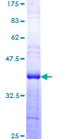 CLK1 / CLK Protein - 12.5% SDS-PAGE Stained with Coomassie Blue