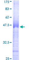 CLK2 Protein - 12.5% SDS-PAGE Stained with Coomassie Blue