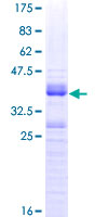 CLK3 Protein - 12.5% SDS-PAGE Stained with Coomassie Blue.