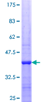 CLK4 Protein - 12.5% SDS-PAGE Stained with Coomassie Blue.