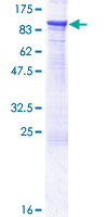 CLLP / CTNNAL1 Protein - 12.5% SDS-PAGE of human CTNNAL1 stained with Coomassie Blue
