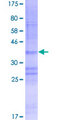 CLLU1 Protein - 12.5% SDS-PAGE of human CLLU1 stained with Coomassie Blue